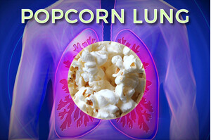 What Is Popcorn Lung